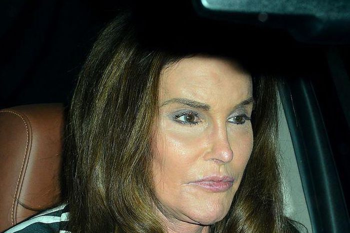 Transgender, Caitlyn Jenner, admits to removing her beards back in the 80's