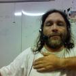 White skinned man who claims he turned dark skinned after injecting himself with controversial drug