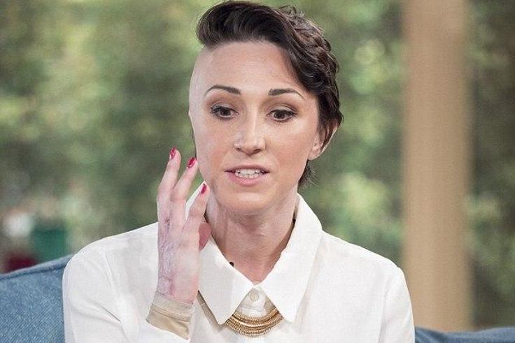 A beautician was disfigured in an acid attack orchestrated by her jealous ex-boyfriend.