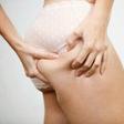 Cellulite