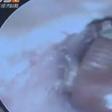 Cockroach gives birth to 25 babies in man's ear