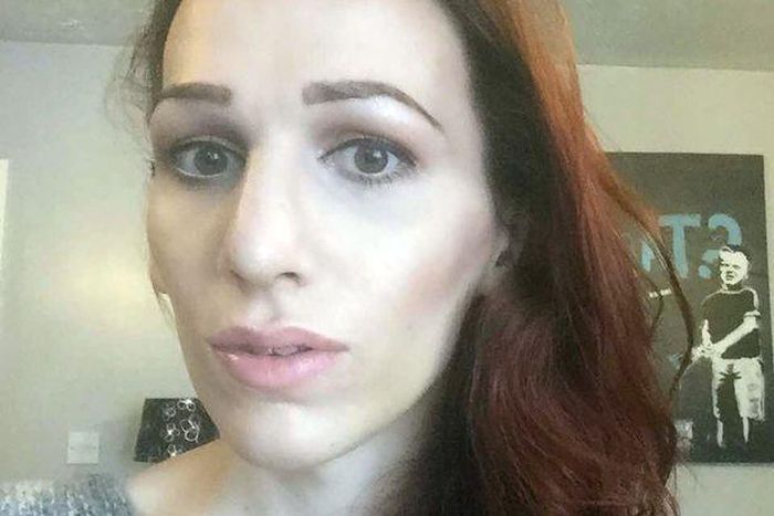 Transgender Nikki Hayden wants to become a woman