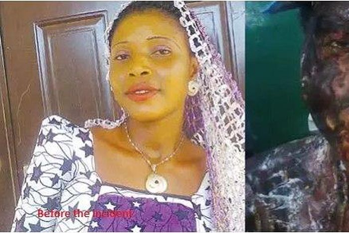 Aladi Sule, before and after the attack