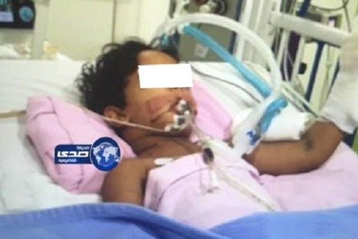 The child battling for his life