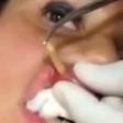 ___4082230___https:______static.pulse.com.gh___webservice___escenic___binary___4082230___2015___8___18___16___A-young-woman-has-a-maggot-removed-from-her-lip