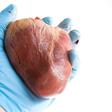 Human heart