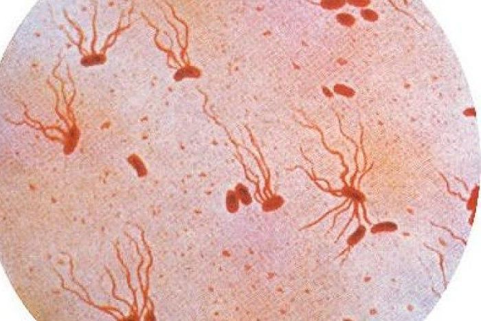 Typhoid: Dearth of laboratory scientists, modern equipment responsible for wrong prescription