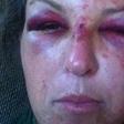 Martha Maclure brutalised while trying to protect 3 toddlers from their father