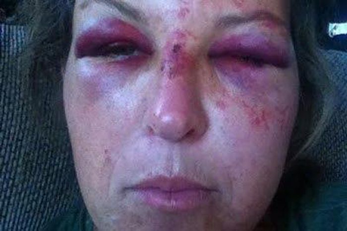 Martha Maclure brutalised while trying to protect 3 toddlers from their father