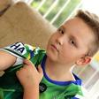 A 9-year-old boy needs plastic surgery after a neighbour's dog bit him on his arm.