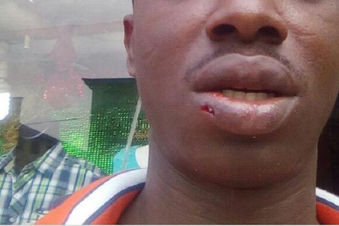 The battered Precious Adeho