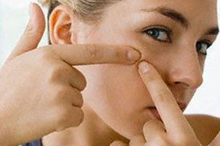 Clogged pores result in breakouts