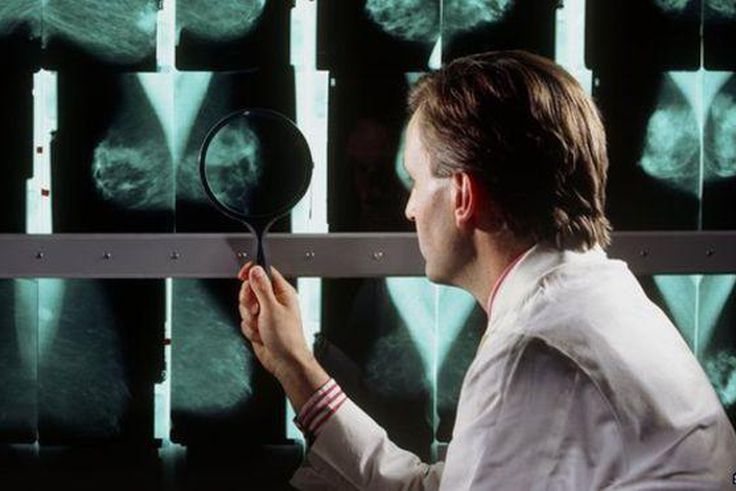 ___3961547___https:______static.pulse.com.gh___webservice___escenic___binary___3961547___2015___7___10___21____84156274_m4150291-doctor_examines_breast_mammograms_on_a_lightbox-spl