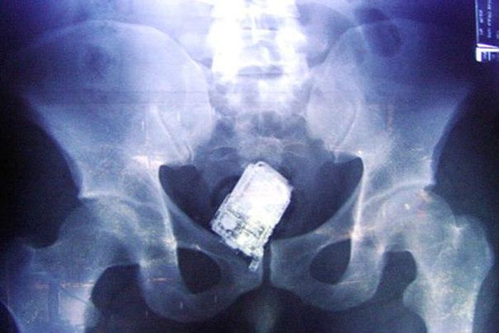 ___3759078___https:______static.pulse.com.gh___webservice___escenic___binary___3759078___2015___5___14___22___PhoneStomach_web_slideshow_604x500