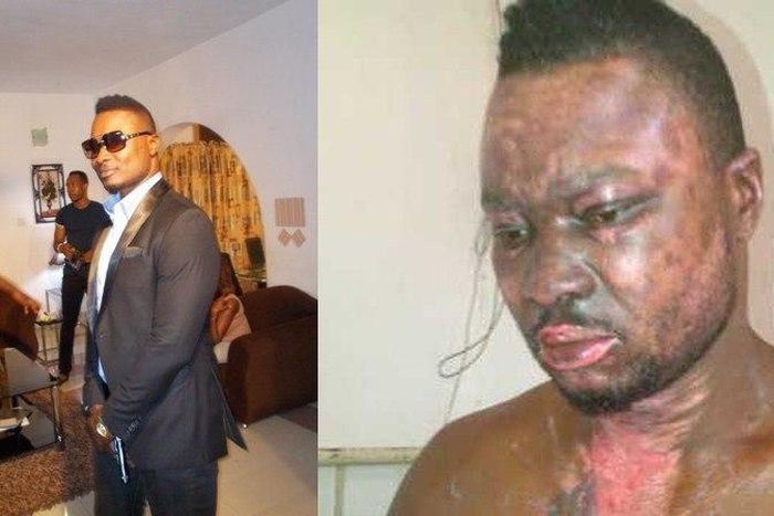 Von Apochi set to make 1st appearance following fire accident