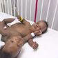 ___3868309___https:______static.pulse.com.gh___webservice___escenic___binary___3868309___2015___6___15___18___marian-michelle-conjoined-twins