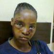Battered woman