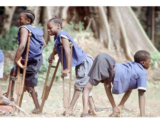 ___3881342___https:______static.pulse.com.gh___webservice___escenic___binary___3881342___2015___6___18___15___polio-victims
