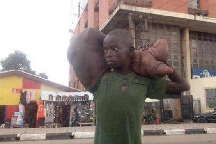This boy needs help