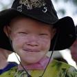 An albino girl smiles in Mitindo Primary School in Nyawilimilwa, Mwanza region of Tanzania, in a file photo. REUTERS/Katrina Manson