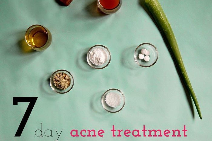A lot of home remedies work well for acne