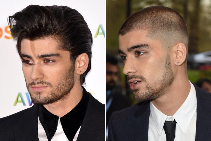 Zayn Malik's before and after