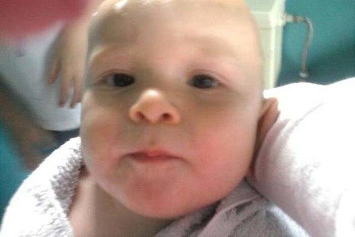 The hand in the background remains unexplained