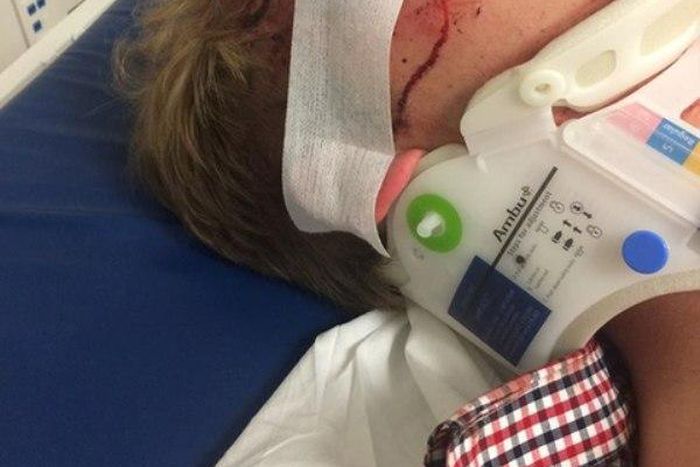 Dalton Gray's eye under treatment by doctors