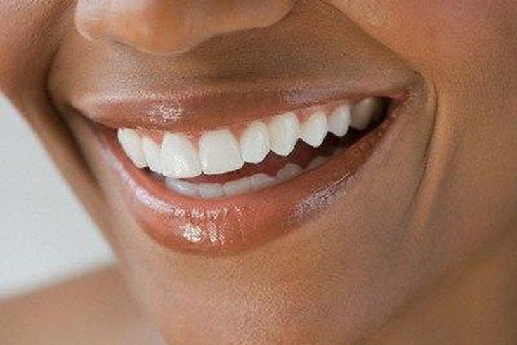 Healthy white teeth