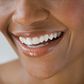 Healthy white teeth