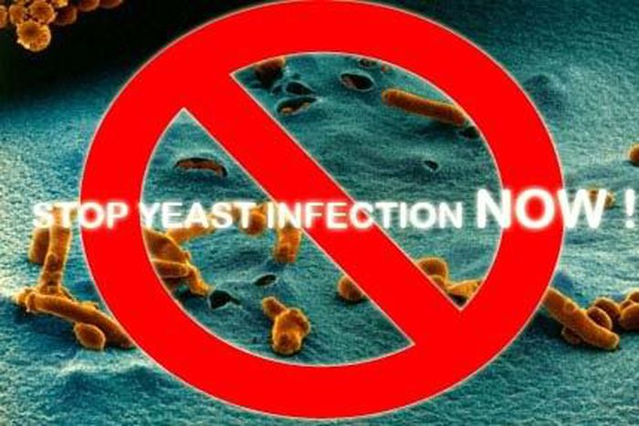 Yeast infection