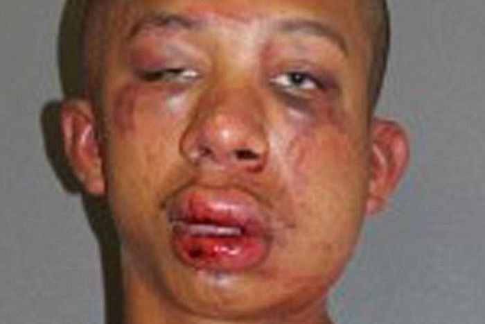 ___3841969___https:______static.pulse.com.gh___webservice___escenic___binary___3841969___2015___6___8___17___o-MAN-BEAT-UP-ATTACKER-facebook