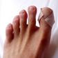 Runners blisters
