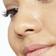 pimples cover