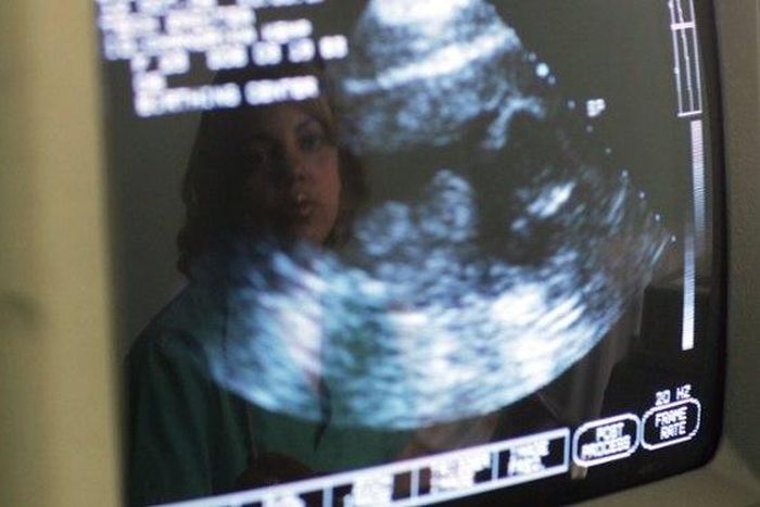 Top court rejects North Carolina abortion ultrasound case