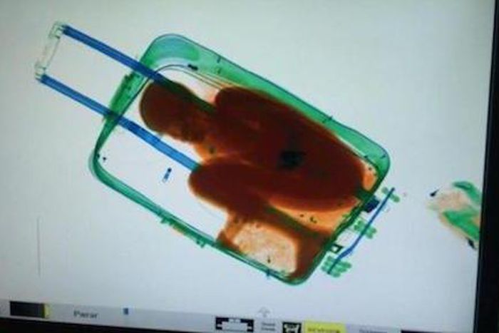 X-ray image of boy hidden in a box