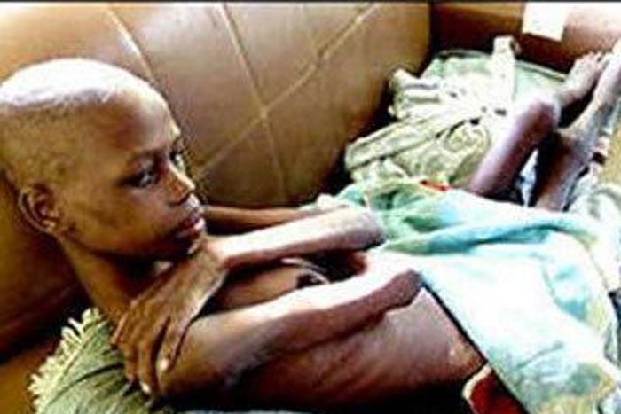 ___3944661___https:______static.pulse.com.gh___webservice___escenic___binary___3944661___2015___7___6___19___LIVING-WITH-AIDS-1