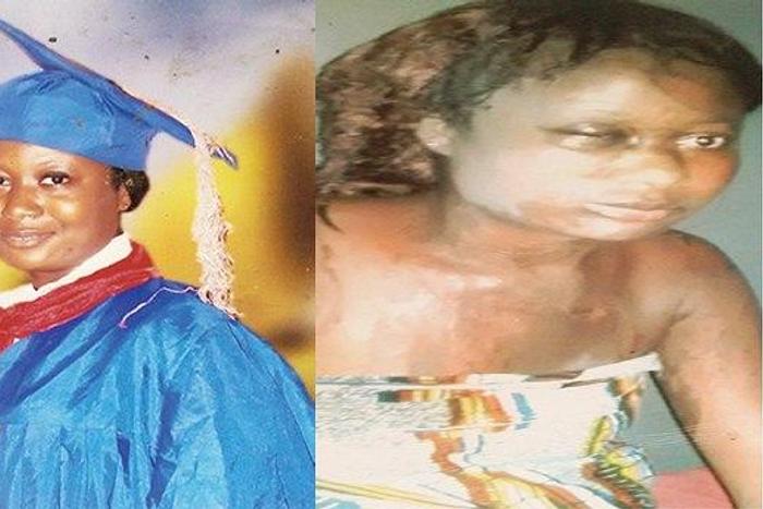 Rosemary Nanaifa (Before and after)