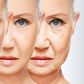 Aging