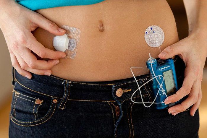 ___3936336___https:______static.pulse.com.gh___webservice___escenic___binary___3936336___2015___7___3___18___ps_140505_insulin_pump_800x600