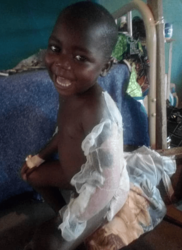 The victim is with a smile while recovering from his injuries. - News Makers