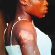 Kafayat Bello was brutalised by her father