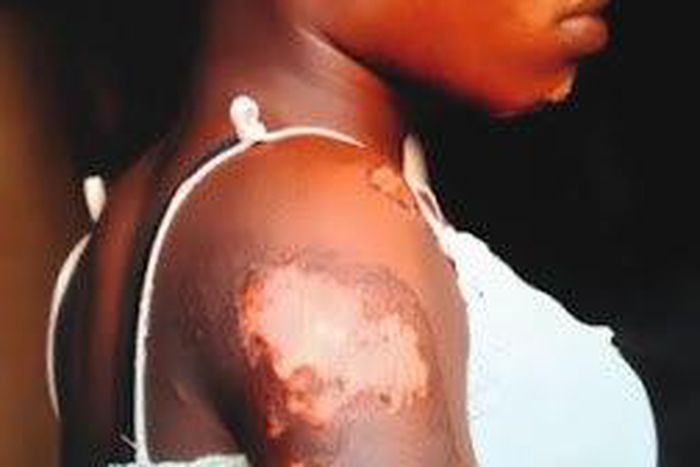Kafayat Bello was brutalised by her father