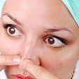 Home remedies work to remove blackheads