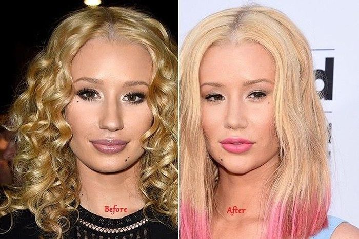 Iggy Azalea
