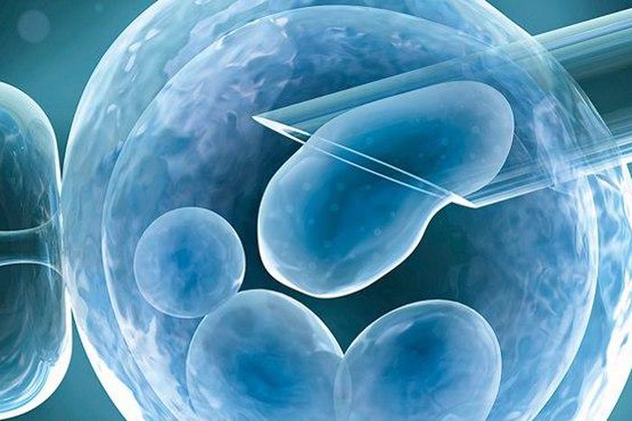 ___3778830___https:______static.pulse.com.gh___webservice___escenic___binary___3778830___2015___5___20___15___ivfm