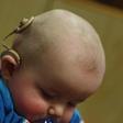 An infant with cochlear implant