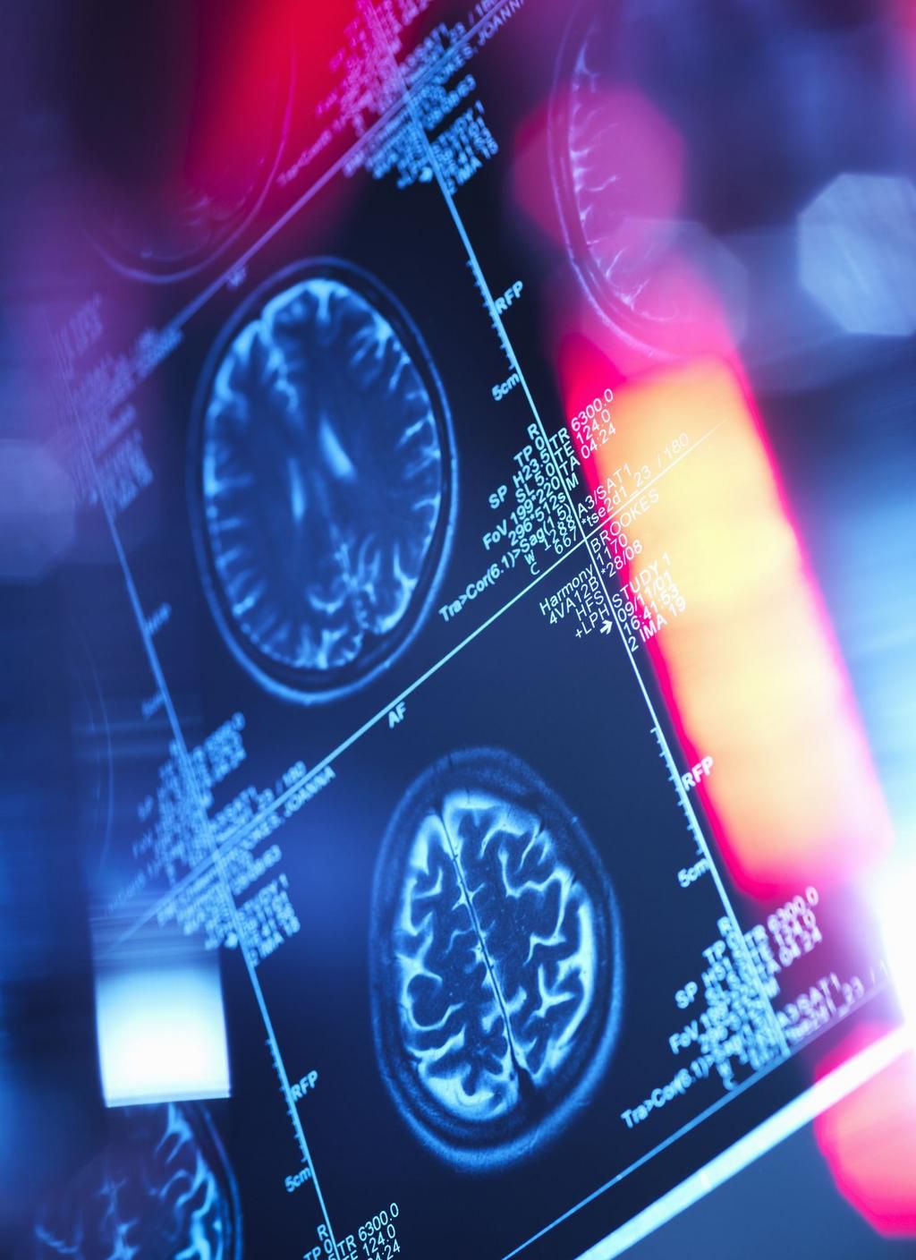 Human brain scan in a neurology clinic