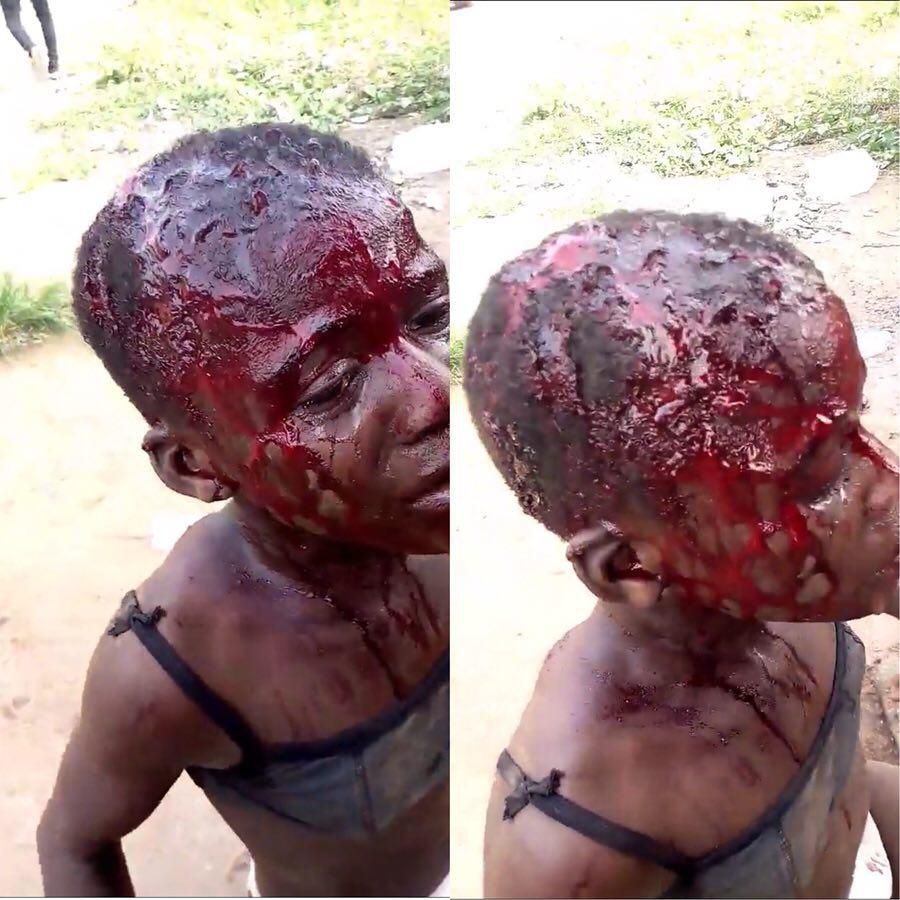 She was stabbed in the head by the pregnant lady