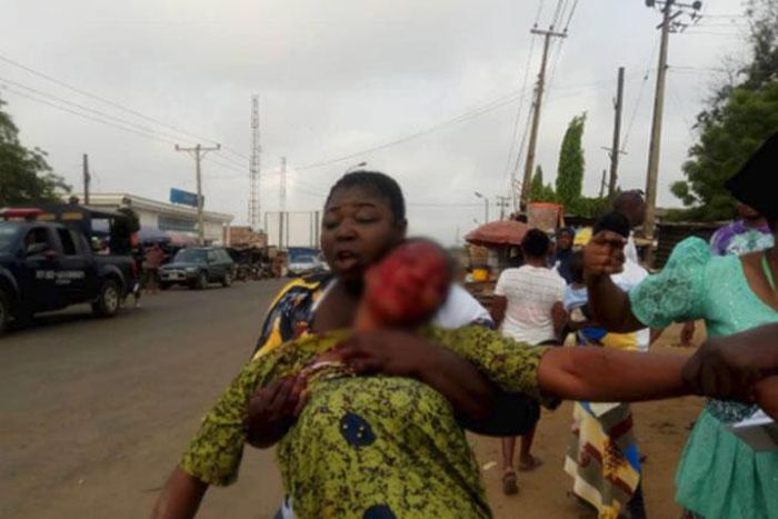 A woman helps another to walk after she was stabbed at a polling unit. [Channels TV]